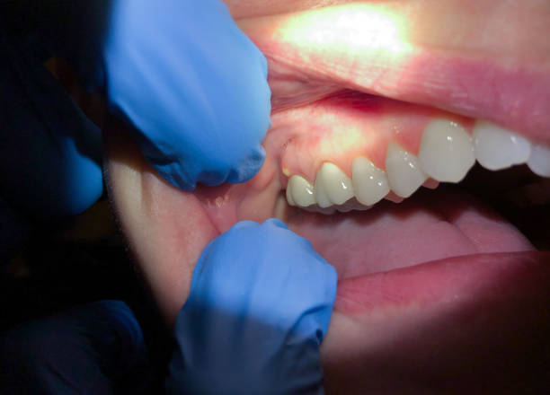 Best Weekend Emergency Dentist in Berry Hill, TN