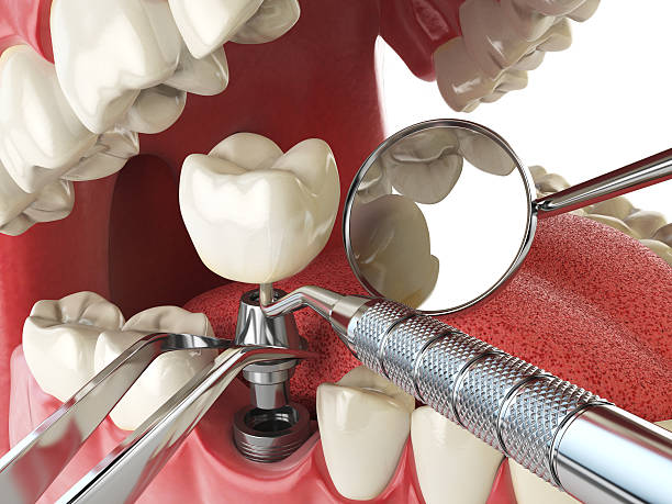 Best Urgent Dental Care for Toothache in Berry Hill, TN